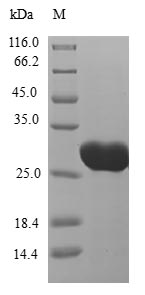 SDS-PAGE