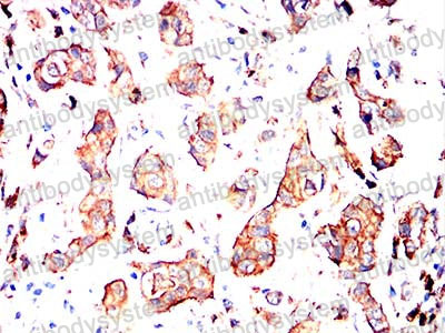 Валидация AntibodySystem RHA52803 (158)