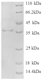 SDS-PAGE
