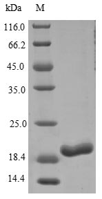 SDS-PAGE