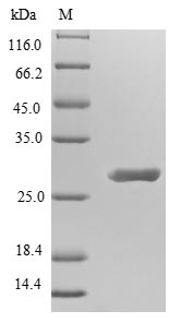 SDS-PAGE