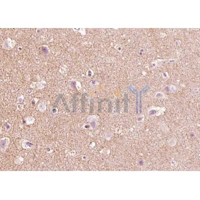 Валидация Affinity AF5124 - 2496