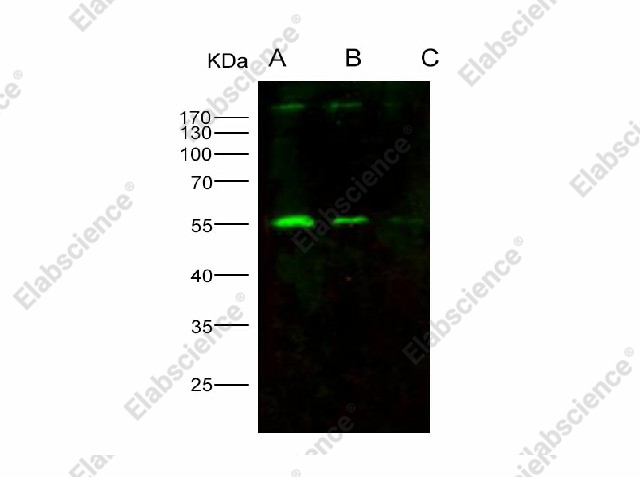 Вестерн-блоттинг, HIV-p51/RT-p51, рекомбинантный белок