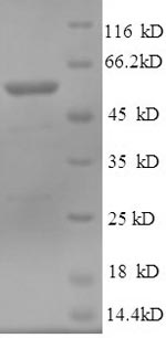 SDS-PAGE