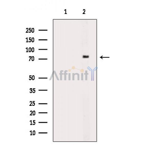 Валидация Affinity DF10138 - 5658