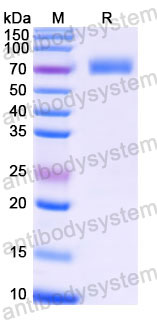 EHC36902, SDS-PAGE