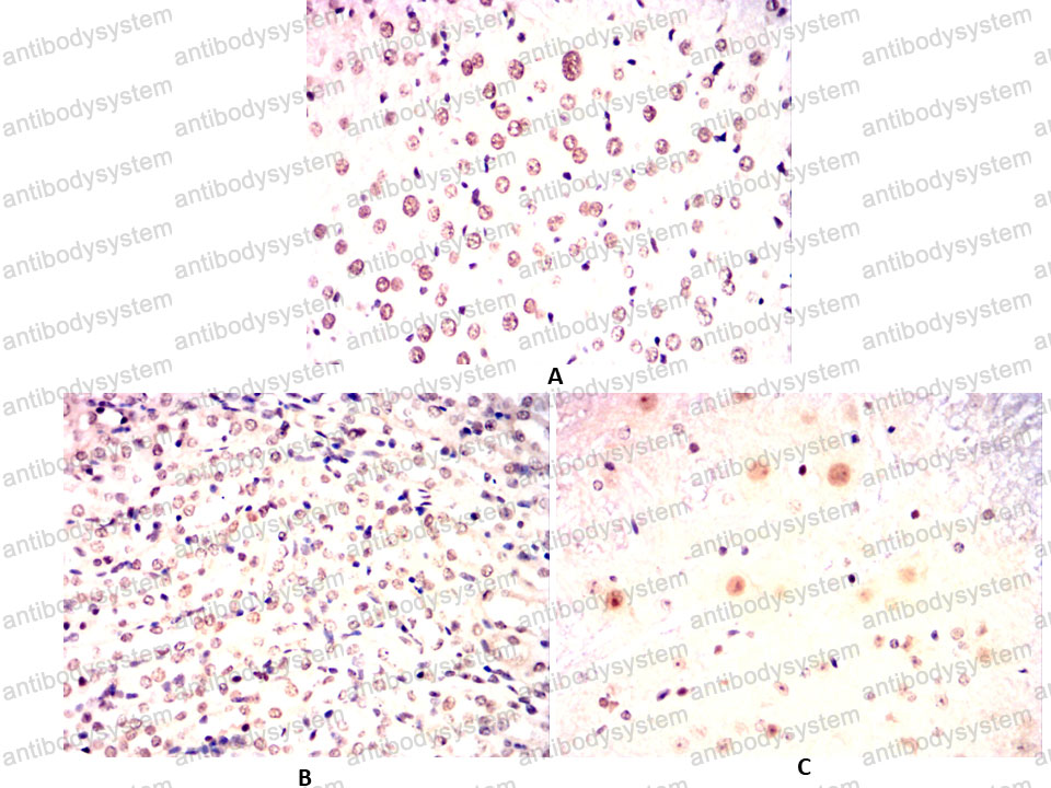 Валидация AntibodySystem RHD35301 (1518)