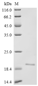 SDS-PAGE