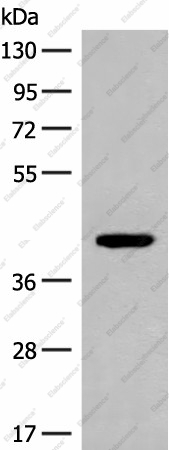 Вестерн-блоттинг, FCGRT, клетки 293T