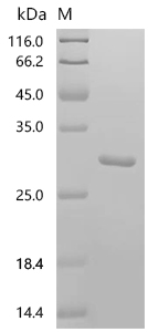 SDS-PAGE
