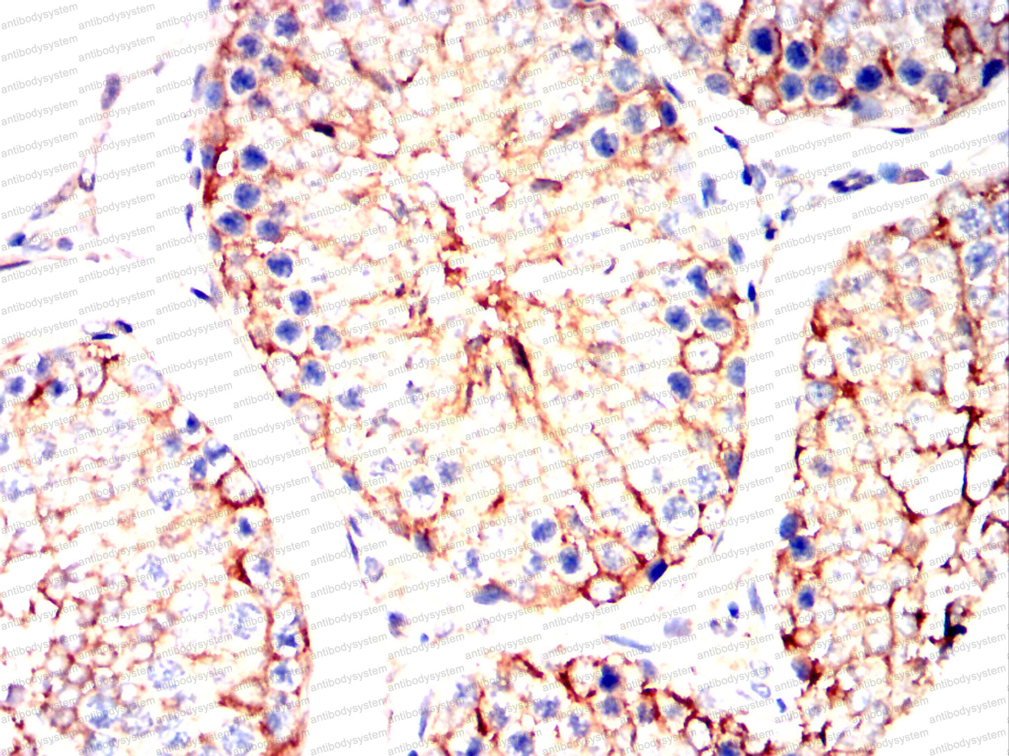 Валидация AntibodySystem RHC88403