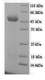 SDS-PAGE