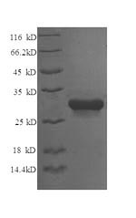 SDS-PAGE