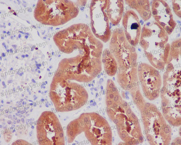 Валидация AntibodySystem RHB91701