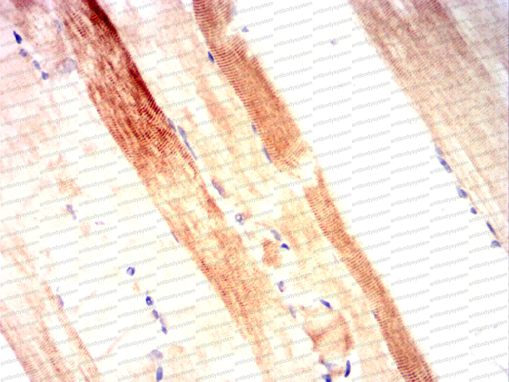 Валидация AntibodySystem RHG72104 (3067)