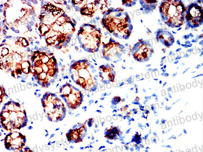 Валидация AntibodySystem RHF96003 (2751)