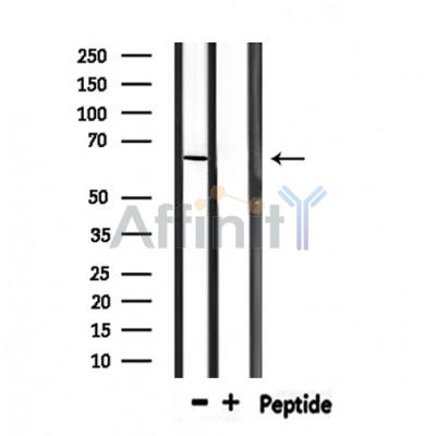Валидация Affinity DF6644 - 18114