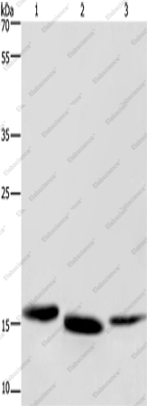 Вестерн-блоттинг, Cytochrome b5, ткань рака почки человека, печень мыши и карциномы мочевого пузыря человека