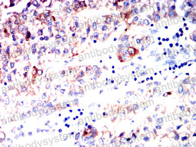 Валидация AntibodySystem RHC01503