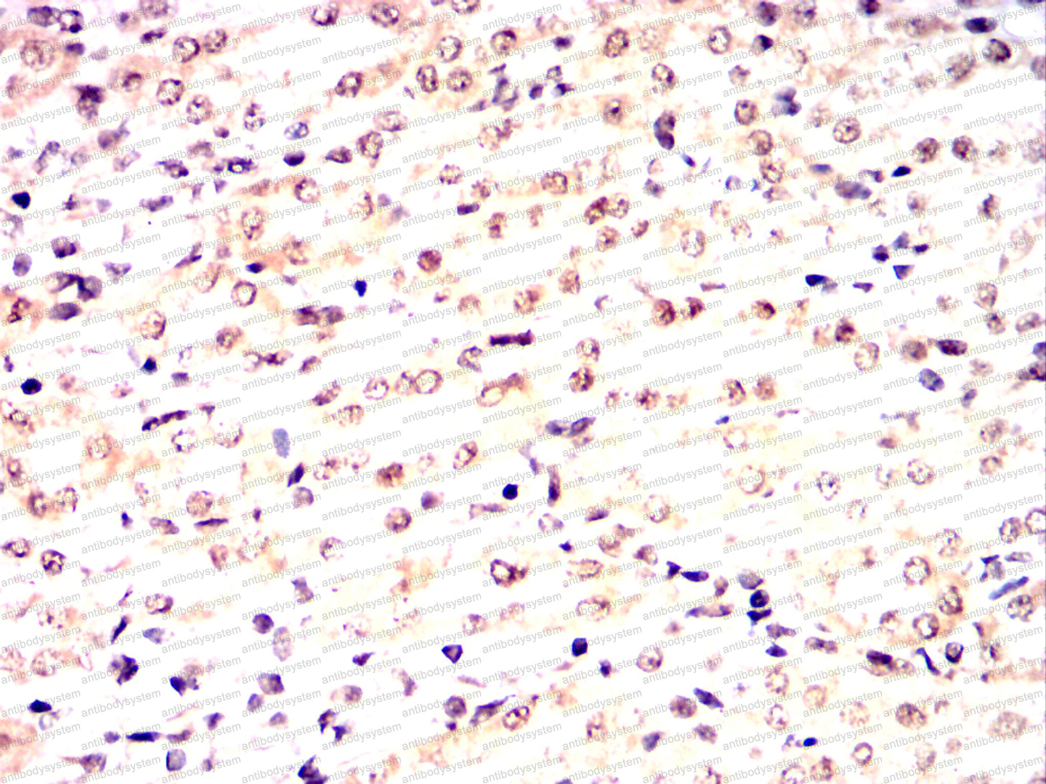 Валидация AntibodySystem RHE78702 (2326)