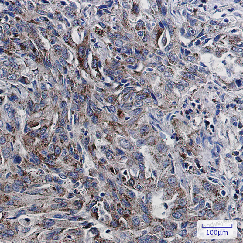 Валидация AntibodySystem RHC97403