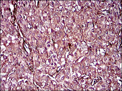 Валидация AntibodySystem RHE39702 (2144)