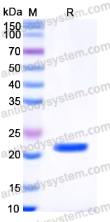 YHK72002, SDS-PAGE
