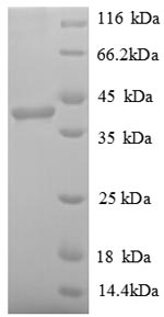 SDS-PAGE