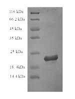 SDS-PAGE