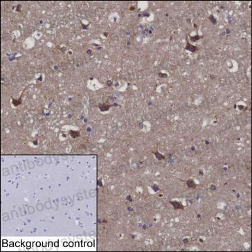 Валидация AntibodySystem RHC84102