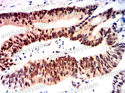 Валидация AntibodySystem RHG58203