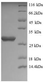 SDS-PAGE
