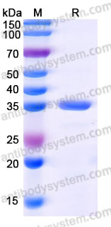 AHJ92801, SDS-PAGE