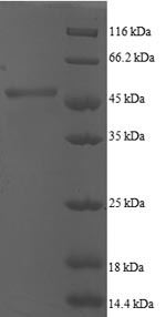 SDS-PAGE