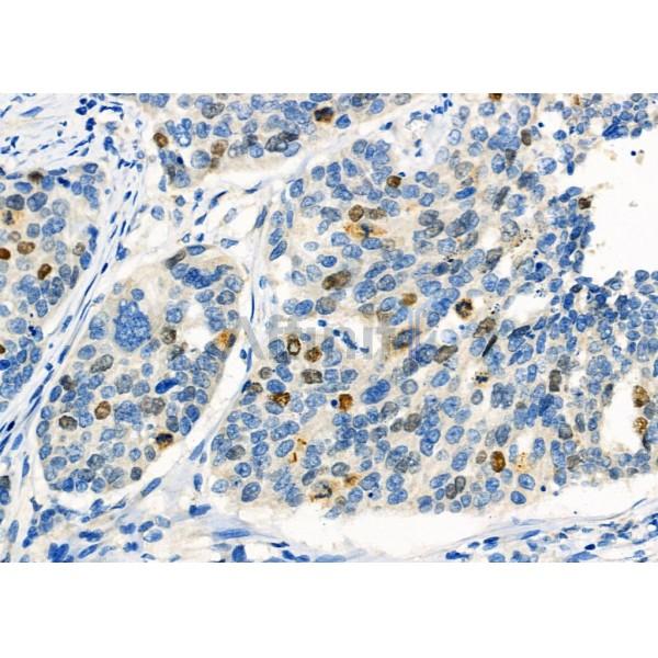 Валидация Affinity DF6510 - 17918