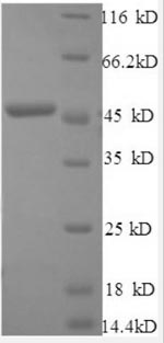 SDS-PAGE