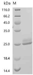 SDS-PAGE