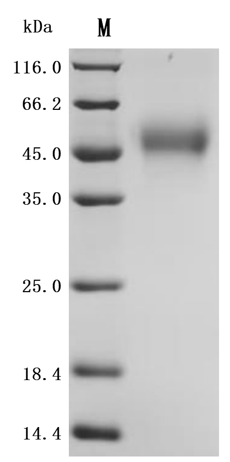 SDS-PAGE