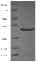 SDS-PAGE