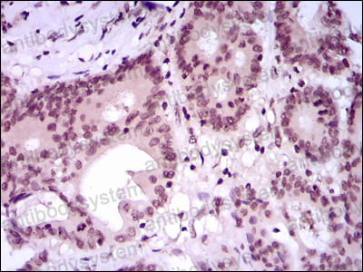 Валидация AntibodySystem RHG08704 (2831)