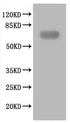 SDS-PAGE