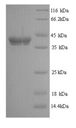 SDS-PAGE