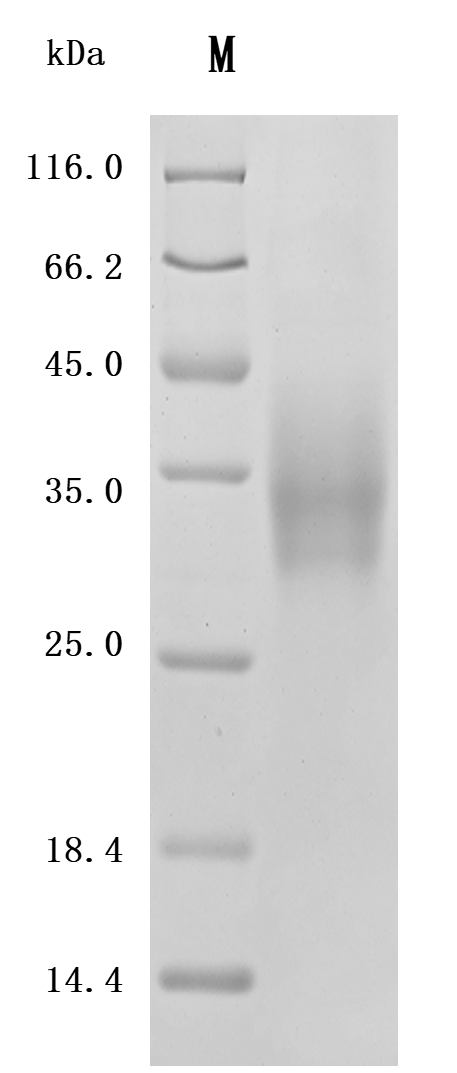 SDS-PAGE