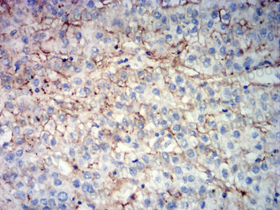 Валидация AntibodySystem RHJ31002 (3365)