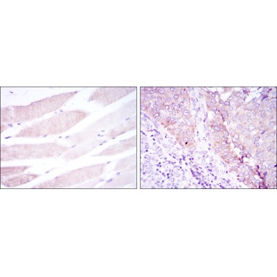 Валидация Affinity BF0342 - 5230