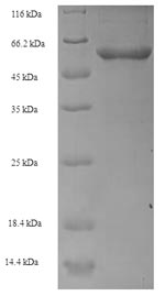 SDS-PAGE