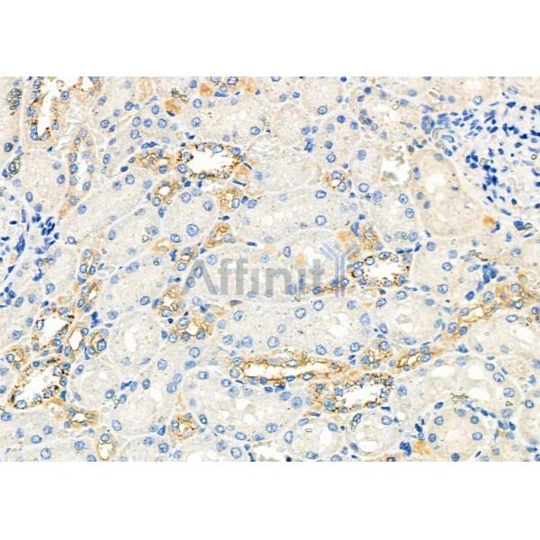 Валидация Affinity DF6004 - 17225