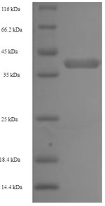 SDS-PAGE
