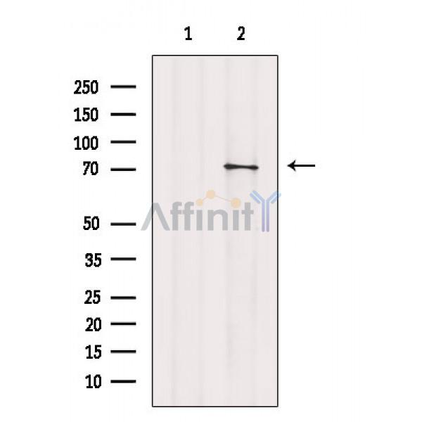 Валидация Affinity AF6774 - 4017