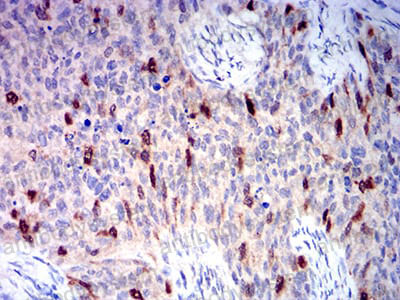 Валидация AntibodySystem RHA36105 (115)